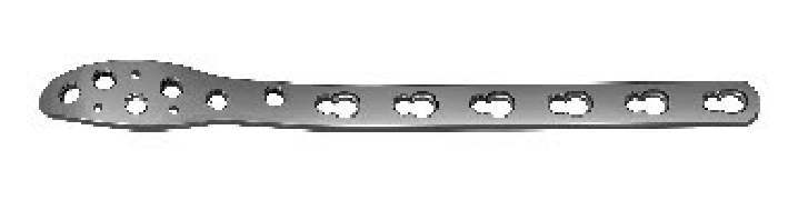 Дистальна малогомілкова блокуюча пластина UMP